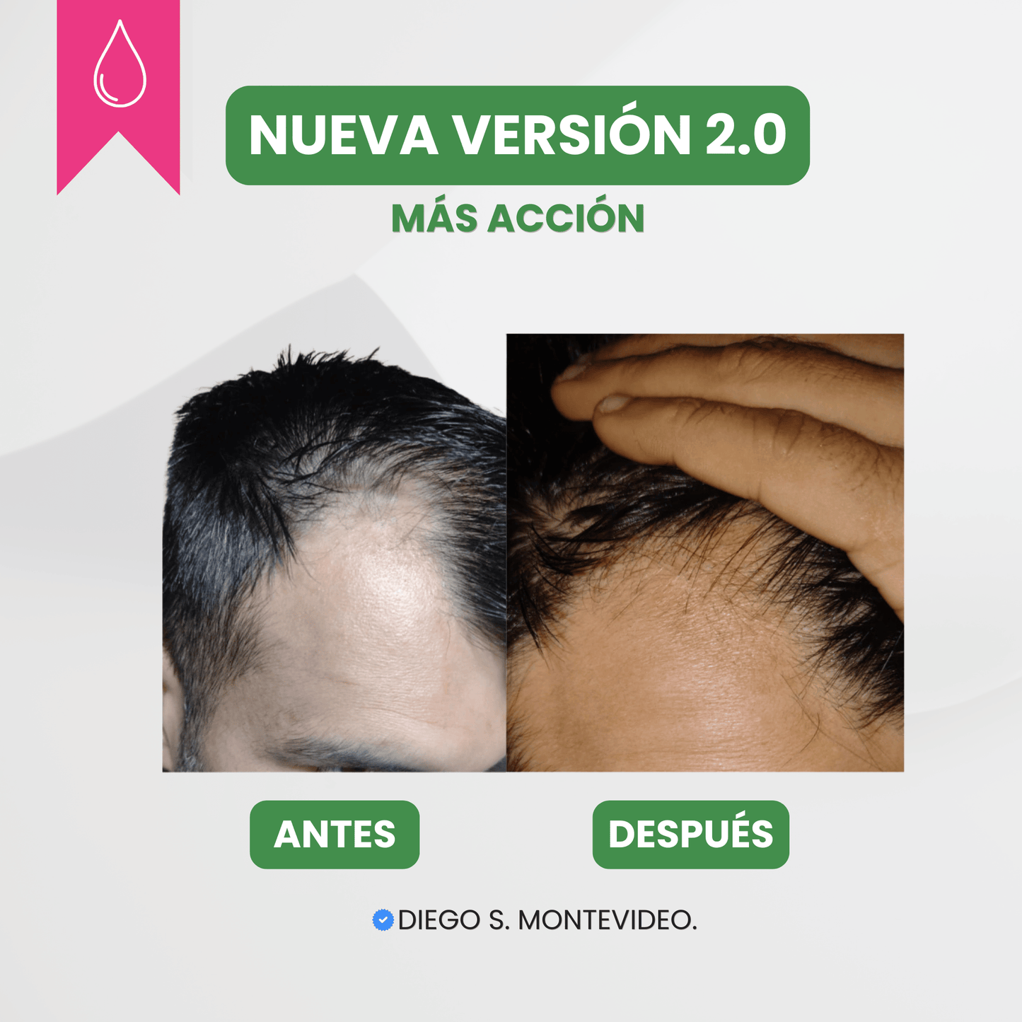 Serum anti caída - Nueva Fórmula 2.0