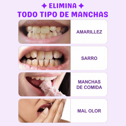 Blanqueador | Lemon Smile™ Extra fuerte.