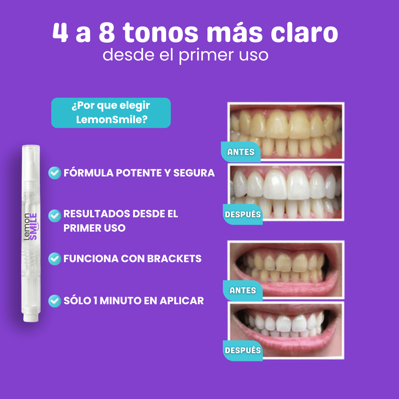 Blanqueador | Lemon Smile™ Extra fuerte.