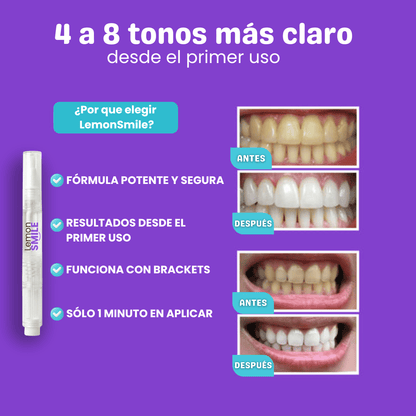 Blanqueador | Lemon Smile™ Extra fuerte.