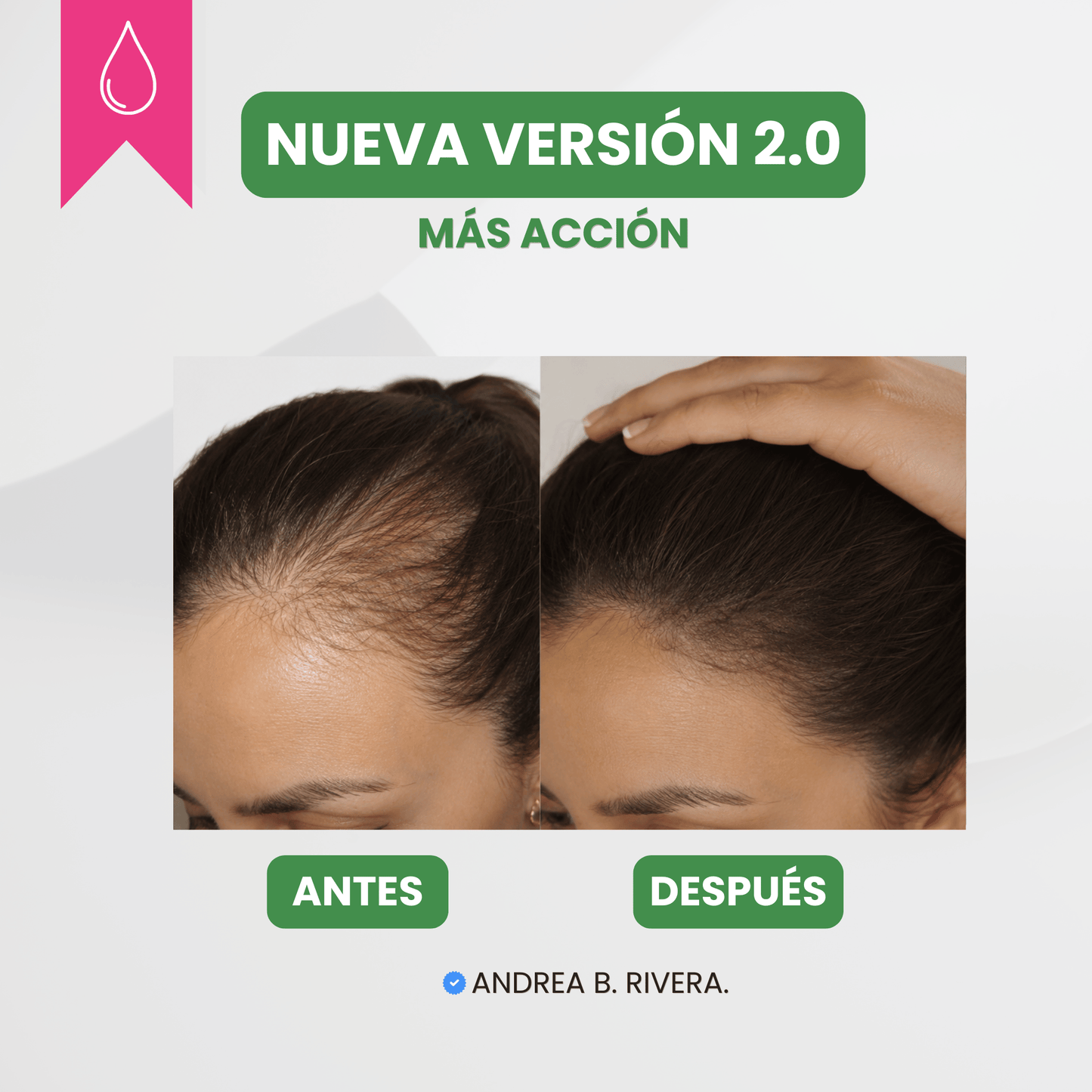 Serum anti caída - Nueva Fórmula 2.0
