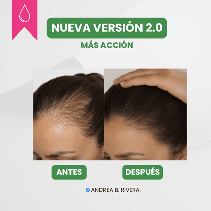 Serum anti caída - Nueva Fórmula 2.0
